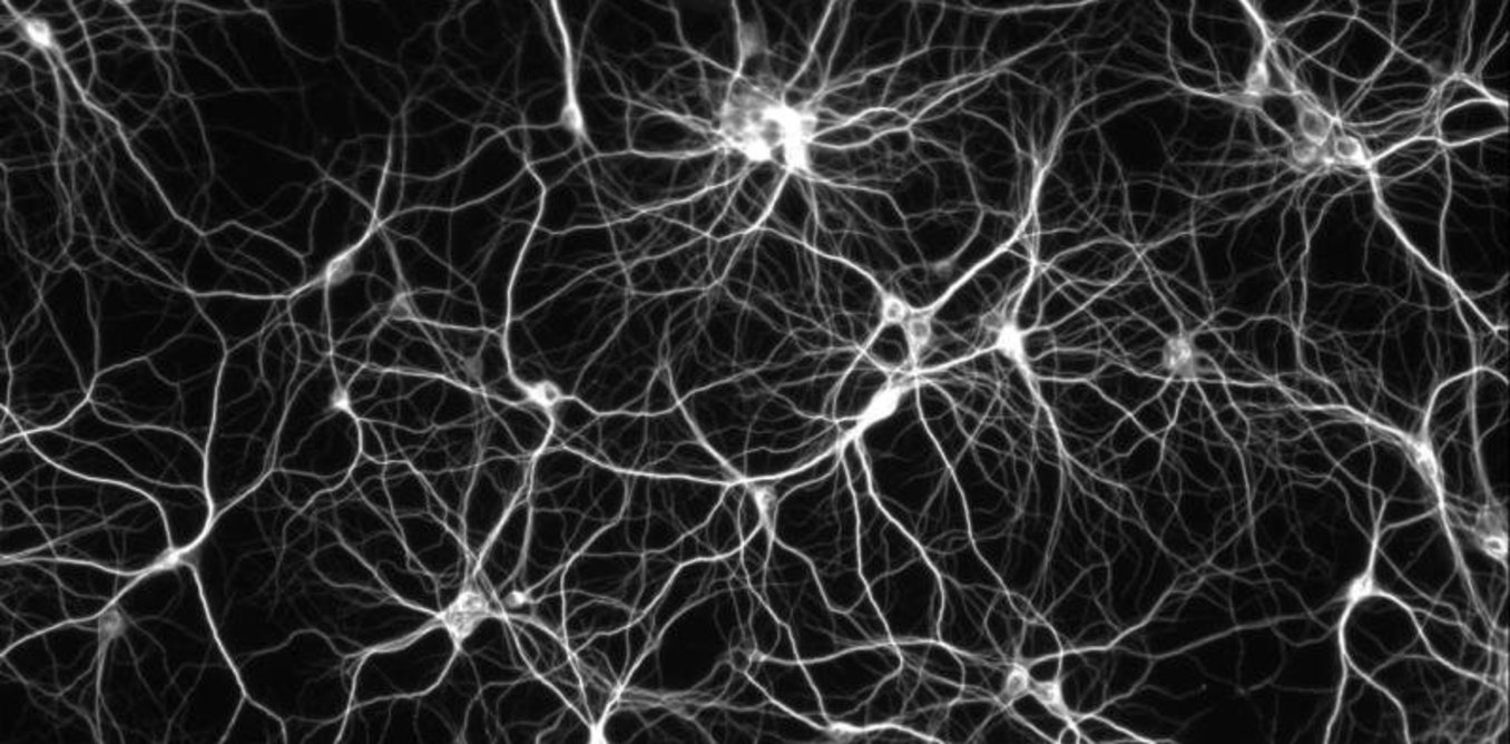 Deep learning, des réseaux de neurones pour traiter l’information