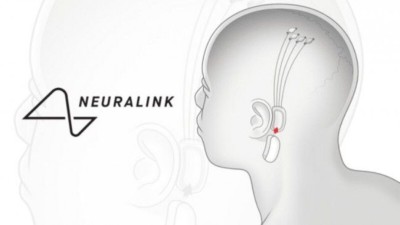neuralink-elon-musk-va-presenter-une-puce-qui-rend-plus-intelligent-et-permet-de-connecter-le-cerveau-aux-machines