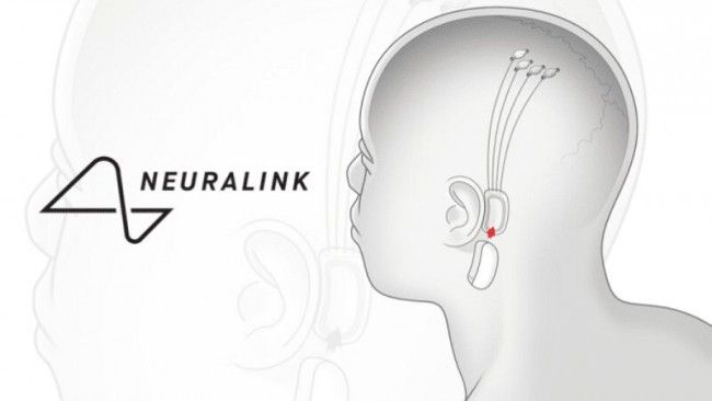 Neuralink : Elon Musk va présenter une puce qui rend plus intelligent et permet de connecter le cerveau aux machines